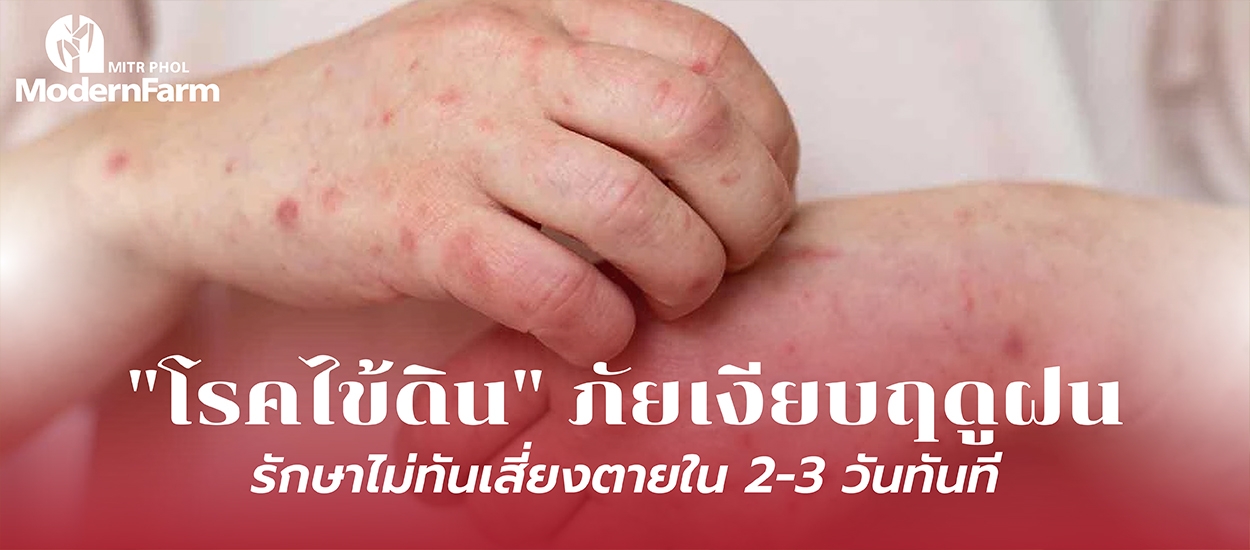 โรคไข้ดิน ภัยเงียบฤดูฝน รักษาไม่ทันเสี่ยงเสียชีวิตใน 2-3 วันทันที